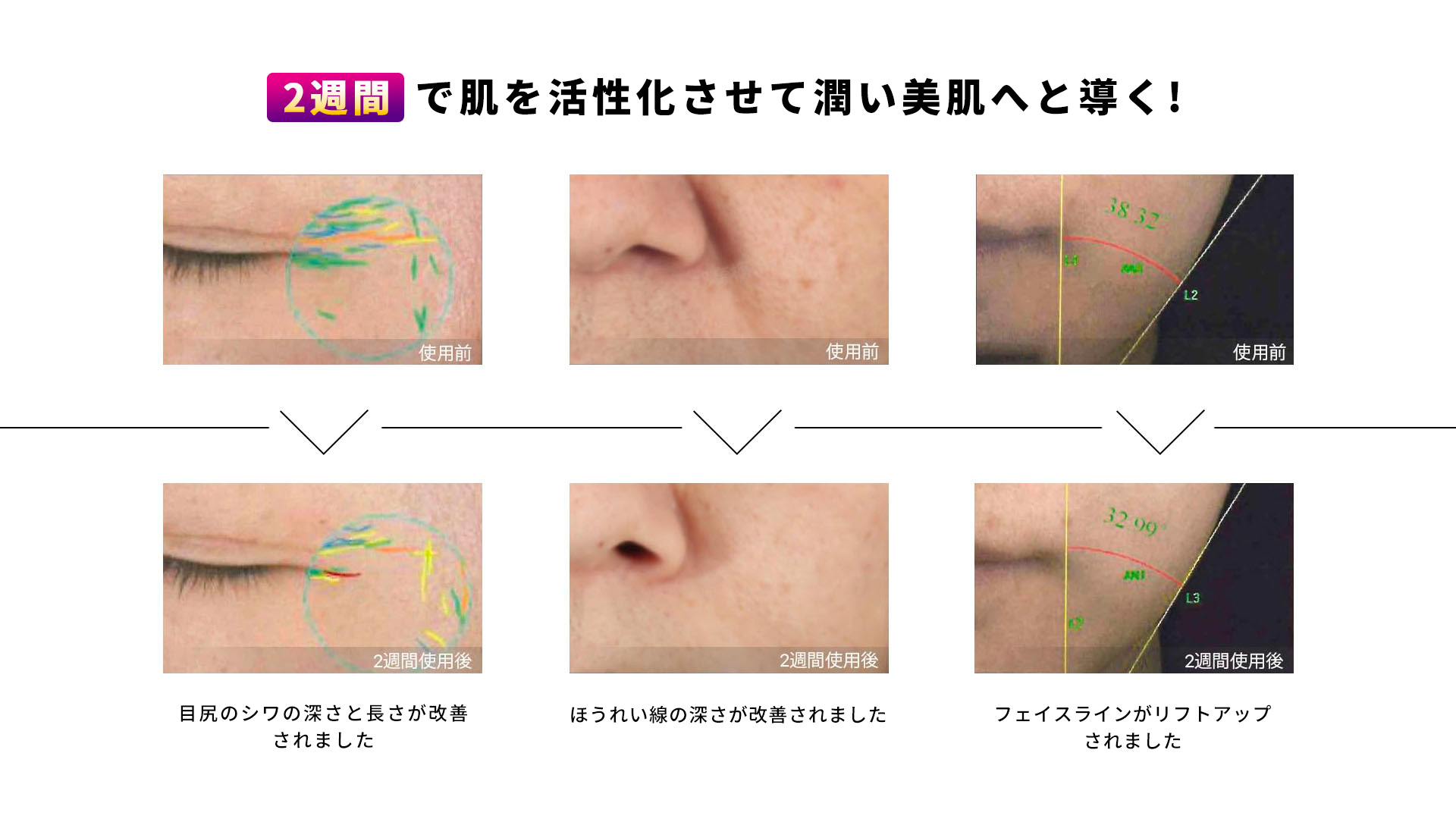 AMIRO 深層RF美顔器 PRO - SeeSea